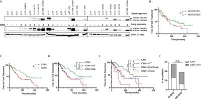 NOTCH1 Activation Negatively Impacts on Chronic Lymphocytic Leukemia Outcome and Is Not Correlated to the NOTCH1 and IGHV Mutational Status